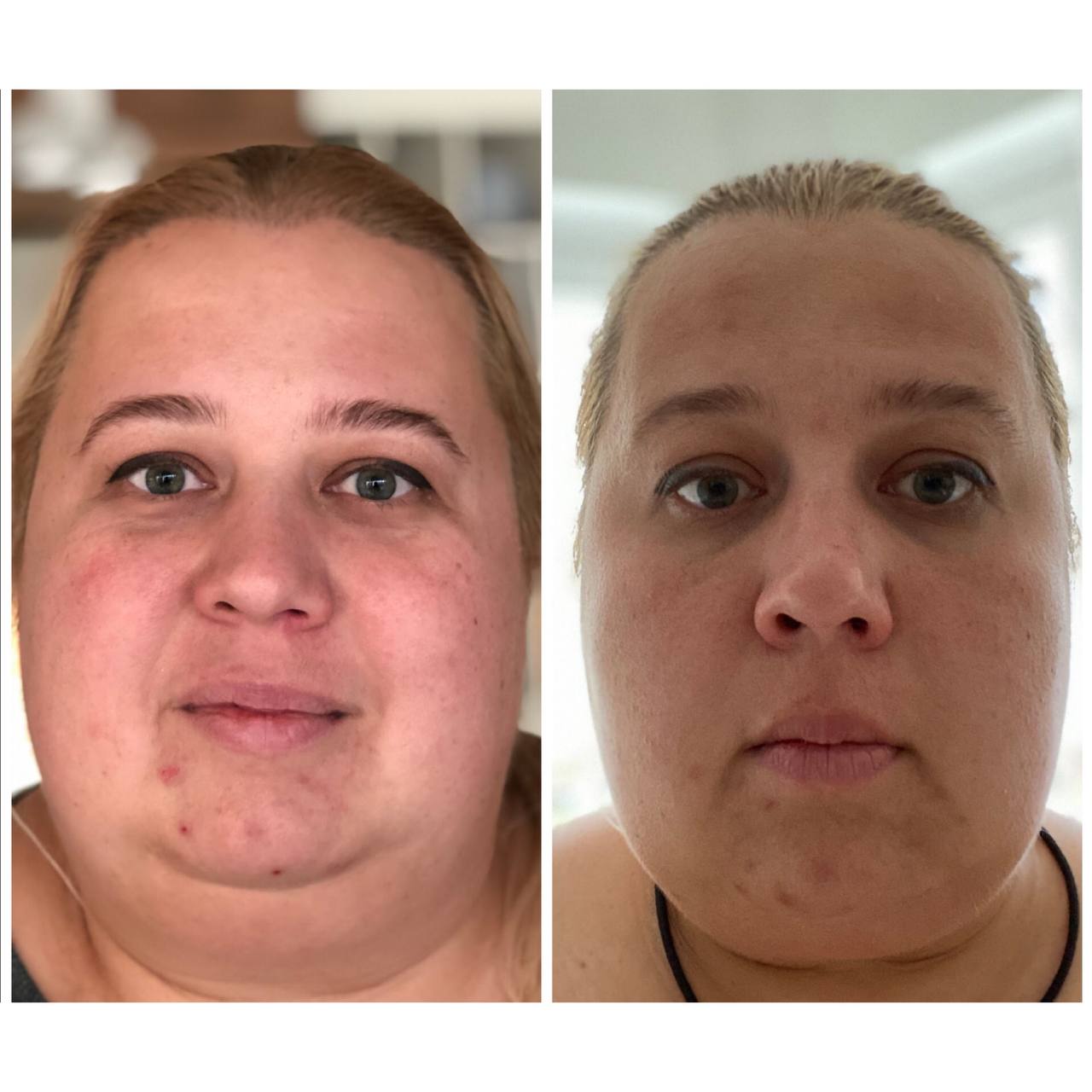 208b5352 9ee1 42be 9c66 2b9cbea70a8d